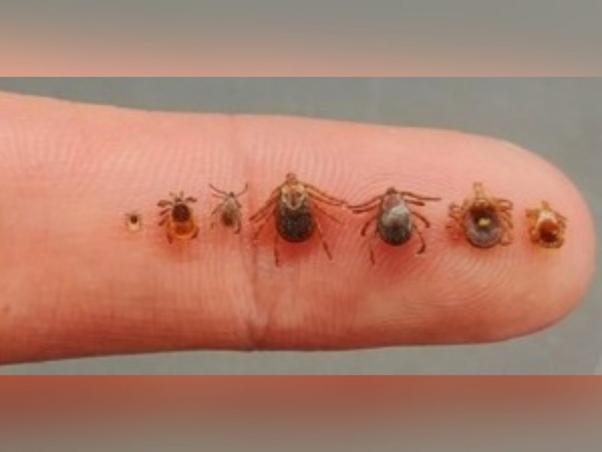 ODNR Ohio Has Three Medically Important Species of Ticks People Should
